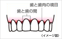 歯と歯肉の境目／歯と歯の間