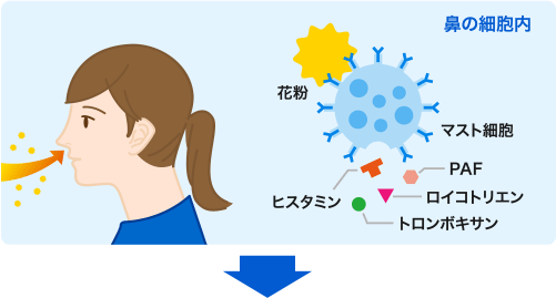 花粉症のはなし 原因とメカニズム アレジオン エスエス製薬