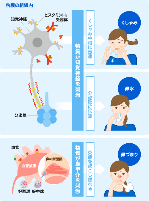 花粉症のはなし 原因とメカニズム アレジオン エスエス製薬