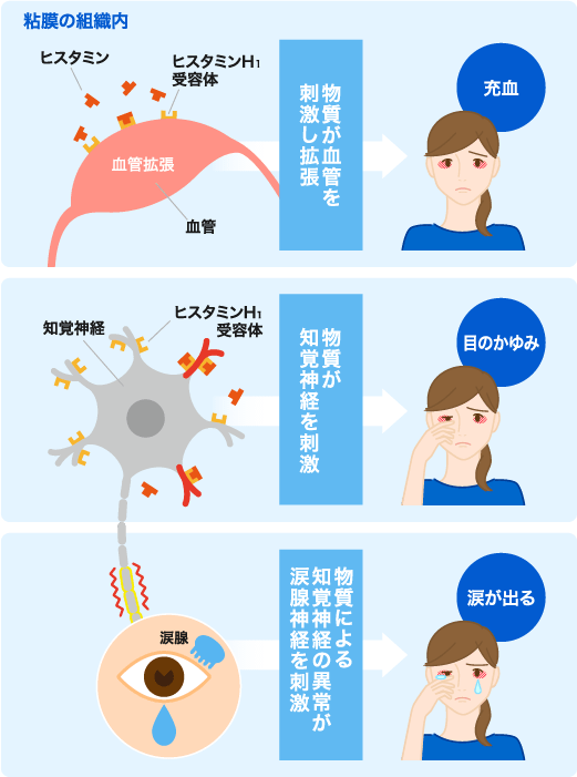 理由 詰まる 鼻 が