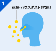 花粉症のはなし 原因とメカニズム アレジオン エスエス製薬