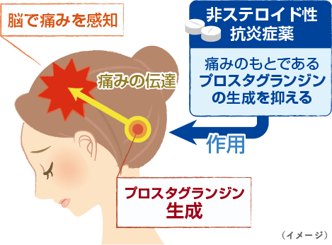 イブプロフェン アセト アミノ フェン 市販 薬