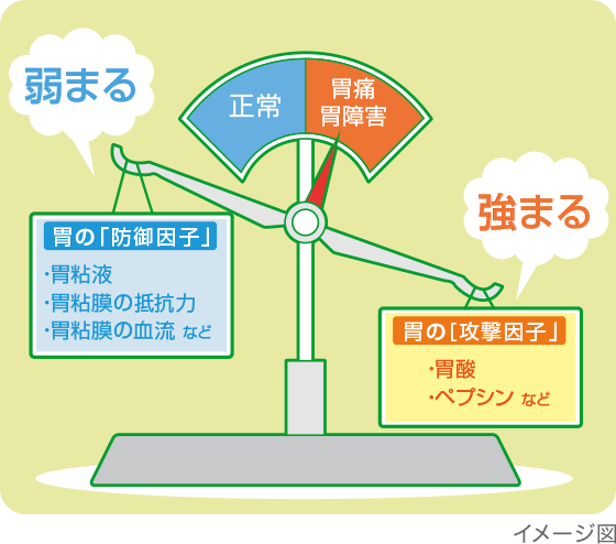 胃の「防御因子」と胃の「攻撃因子」