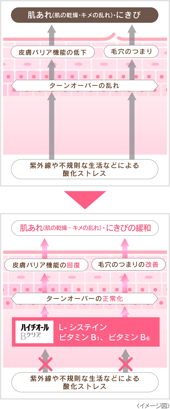 ターンオーバーの乱れと正常化
