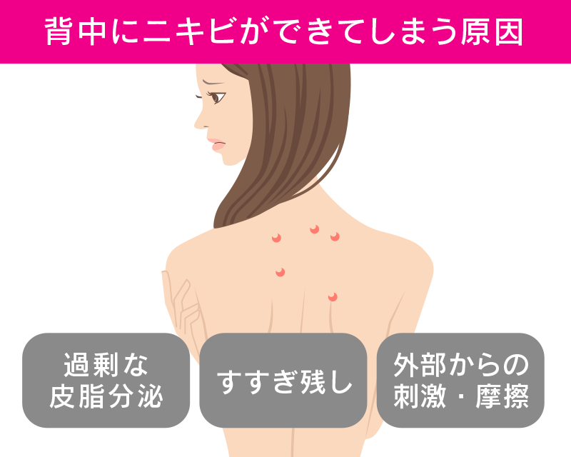 場所と意味 ニキビ 顔ニキビの位置、場所でわかる健康状態と体の調子で治し方はそれぞれ違う！？