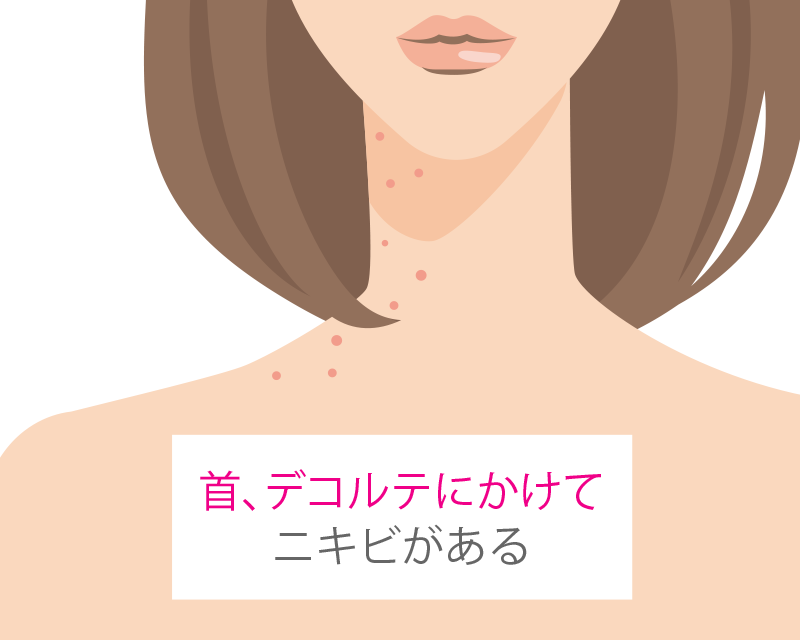 吹き出物 あご あごの吹き出物・大人ニキビは「紫根」でケアしよう