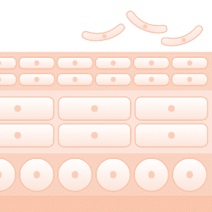 ターンオーバーの乱れ