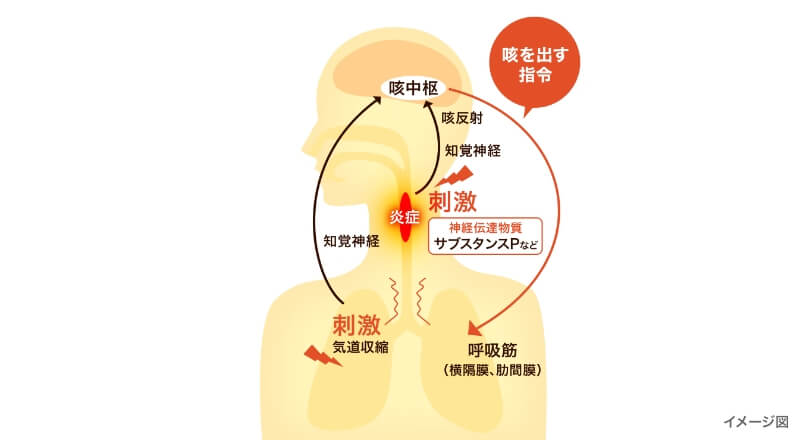 炎症や過敏反応、気道収縮の刺激で起こる咳のイメージ図