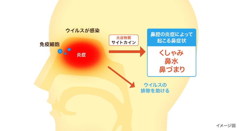 風邪で鼻症状が出る原因のイメージ図