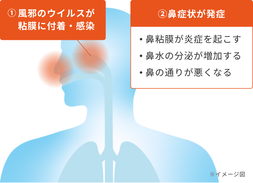 ①風邪のウイルスが粘膜に付着・感染②鼻症状が発症：鼻粘膜が炎症を起こす、鼻水の分泌が増加する、鼻の通りが悪くなる