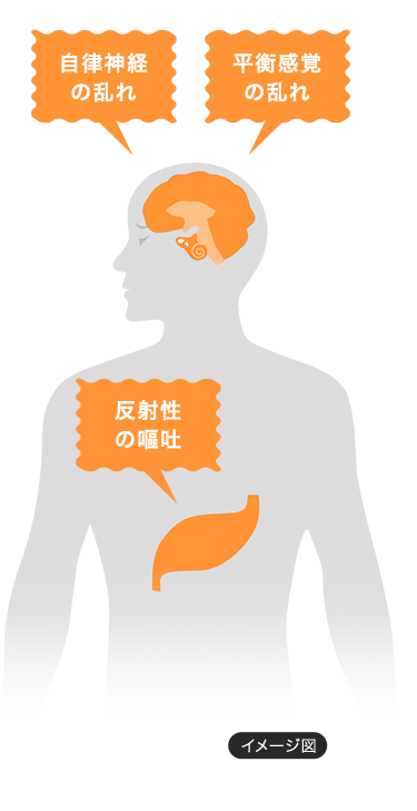 自律神経の乱れ　平衡感覚の乱れ　反射性の嘔吐