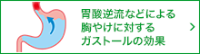 胃酸逆流などによる胸やけに対するガストールの効果