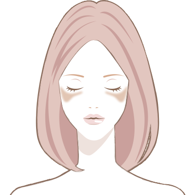 肝斑(かんぱん)のイメージ