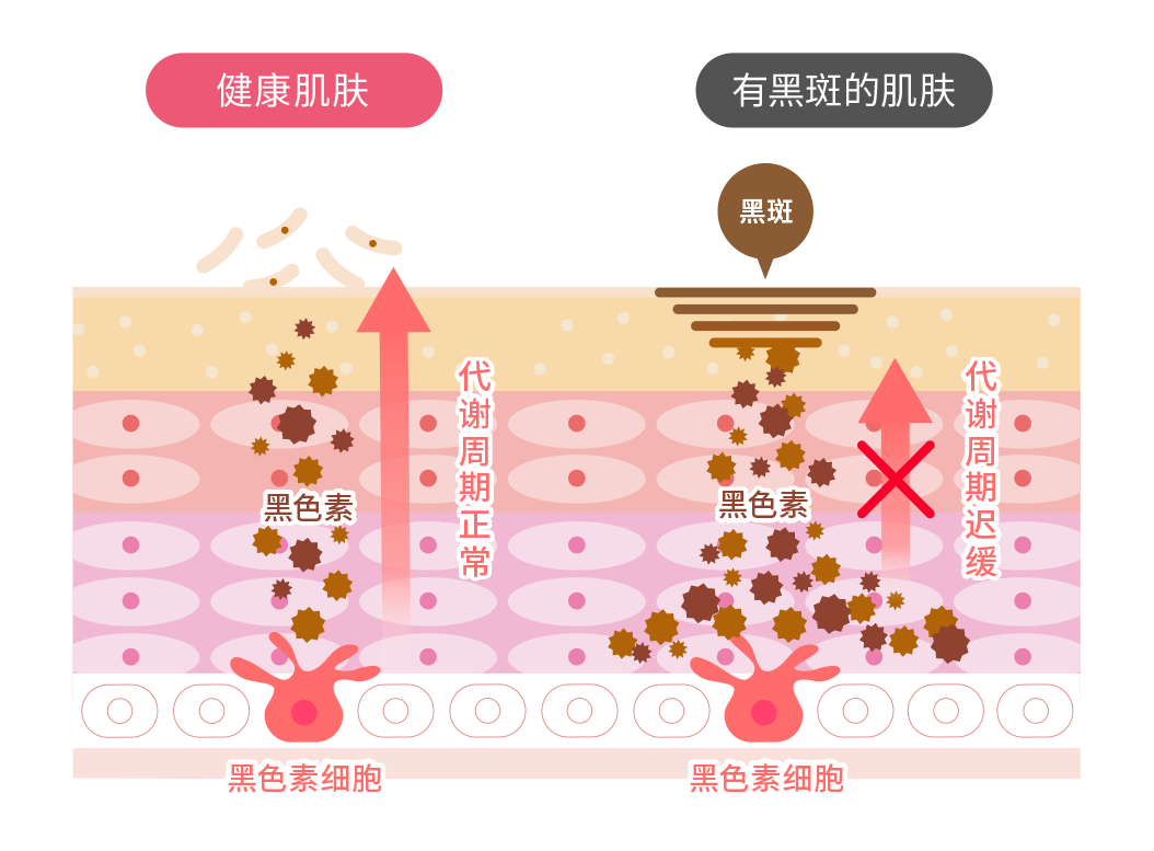 健康肌肤有黑斑的肌肤